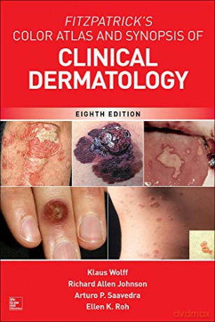 Fitzpatrick's Color Atlas, 8th Ed DERMATOLOGY - Klaus Wolff [KSIĄŻKA]