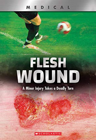 Flesh Wound Xbooks: A Minor Injury Takes a Deadly Turn Xbooks: Medical - Shea Phillips [KSIĄŻKA]