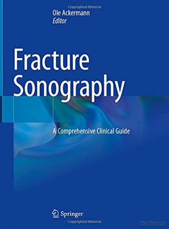 Fracture Sonography: A Comprehensive Clinical Guide - Ole Ackermann [KSIĄŻKA]