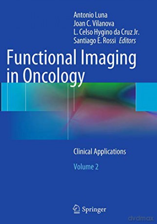 Functional Imaging in Oncology: Clinical Applications - Volume 2 - Antonio Luna [KSIĄŻKA]
