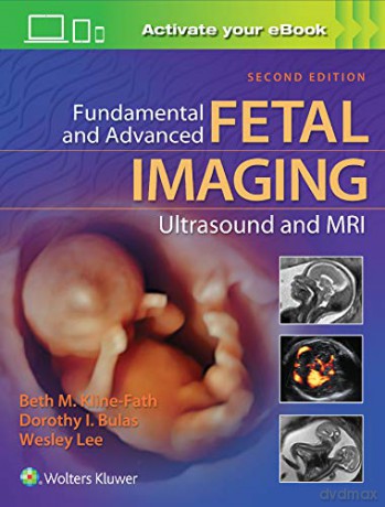Fundamental and Advanced Fetal Imaging Ultrasound and MRI - Beth Kline-Fath MD [KSIĄŻKA]