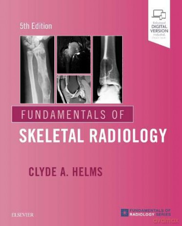 Fundamentals of Skeletal Radiology - Clyde A. Helms MD [KSIĄŻKA]
