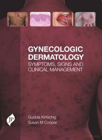 Gynecologic Dermatology: Symptoms, Signs and Clinical Management - Gudula Kirtschig [KSIĄŻKA]