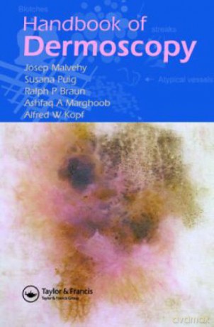 Handbook of Dermoscopy - Josep Malvehy [KSIĄŻKA]