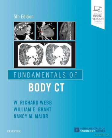 Fundamentals Of Body Ct (Fundamentals Of Radiology) - W. Richard Webb MD [KSIĄŻKA]