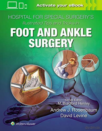 Hospital for Special Surgery's Illustrated Tips and Tricks in Foot and Ankle Surgery - David Levine [KSIĄŻKA]