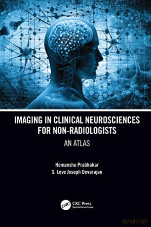 Imaging in Clinical Neurosciences for Non-radiologists: An Atlas - S. Leve Joseph Devarajan [KSIĄŻKA]