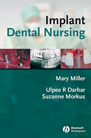 Implant Dental Nursing - Ulpee R. Darbar [KSIĄŻKA]