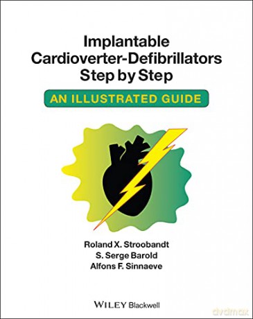 Implantable Cardioverter-defibrillators Step by Step: An Illustrated Guide - Roland X. Stroobandt [KSIĄŻKA]