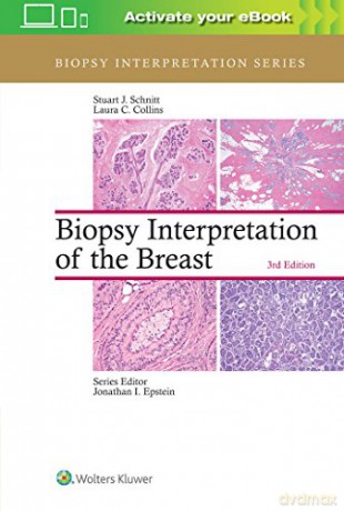 Biopsy Interpretation Of The Breast (Biopsy Interpretation Series) - Stuart J. Schnitt [KSIĄŻKA]
