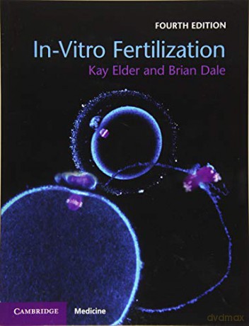 In-Vitro Fertilization - Kay Elder [KSIĄŻKA]