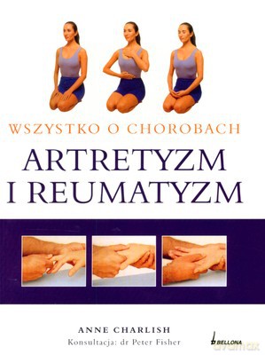 Wszystko O Chorobach Artretyzm I Reumatyzm - Anne Charlish [KSIĄŻKA]