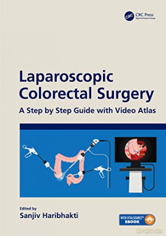 Laparoscopic Colorectal Surgery: A Step by Step Guide with Video Atlas - Sanjiv Haribhakti [KSIĄŻKA]