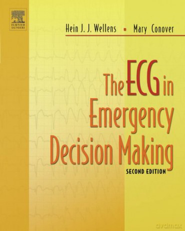 The ECG in Emergency Decision Making, 2e - Mary Boudreau Conover RN BSN [KSIĄŻKA]