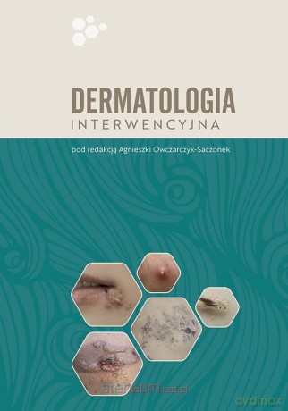 Dermatologia interwencyjna - Agnieszka Owczarczyk-Saczonek [KSIĄŻKA]