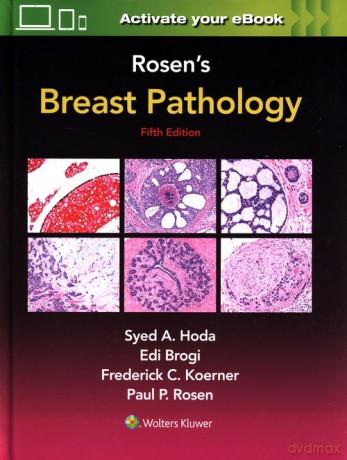 Rosen's Breast Pathology Fifth edition - A. Hoda Syed, Peter Rosen Paul [KSIĄŻKA]