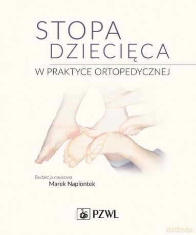 Stopa dziecięca w praktyce ortopedycznej - Marek Napiontek [KSIĄŻKA]