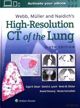 Webb, Müller and Naidich's High-Resolution CT of the Lung Sixth edition - Sujal Desai, David Lynch [KSIĄŻKA]