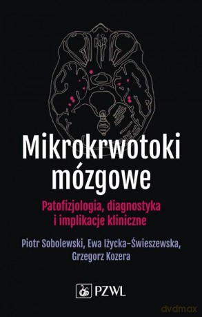 Mikrokrwotoki mózgowe - Piotr Sobolewski, Ewa Iżycka-Świeszewska [KSIĄŻKA]