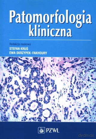 Patomorfologia kliniczna [KSIĄŻKA]