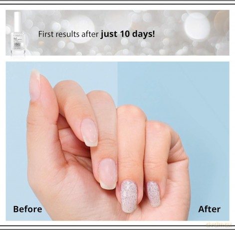 Eveline Nail Therapy Lakier odżywka do paznokci 8w1 Total Action Silver Shine 12 ml