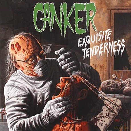 Canker: Exquisite Tenderness [CD]
