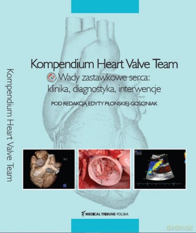 Kompendium Heart Valve Team [KSIĄŻKA]