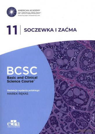 Soczewka i zaćma [KSIĄŻKA]