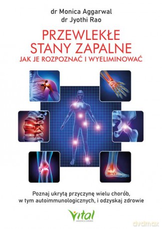 Przewlekłe stany zapalne. Jak je rozpoznać i wyeliminować. Poznaj ukrytą przyczynę wielu chorób, w tym autoimmunologicznych, i odzyskaj zdrowie - Monica Aggarwal,Jyothi Rao [KSIĄŻKA]