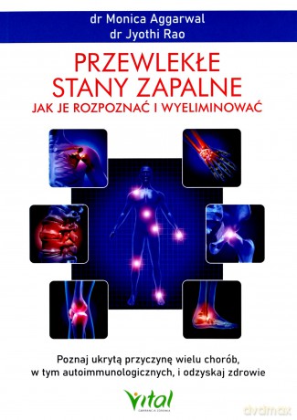 Przewlekłe stany zapalne. Jak je rozpoznać i wyeliminować. Poznaj ukrytą przyczynę wielu chorób, w tym autoimmunologicznych, i odzyskaj zdrowie - Monica Aggarwal,Jyothi Rao [KSIĄŻKA]