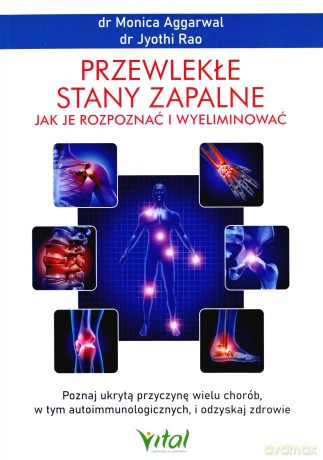 Przewlekłe stany zapalne. Jak je rozpoznać i wyeliminować. Poznaj ukrytą przyczynę wielu chorób, w tym autoimmunologicznych, i odzyskaj zdrowie - Monica Aggarwal,Jyothi Rao [KSIĄŻKA]