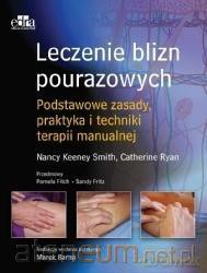 Leczenie blizn pourazowych - C. Ryan, N. Keeney-Smith [KSIĄŻKA]