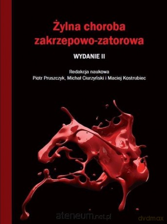 Żylna choroba zakrzepowo-zatorowa - Pruszczyk Piotr, Ciurzyński Michał, Kostrubiec Maciej [KSIĄŻKA]