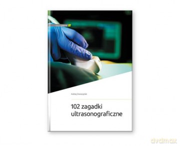 102 zagadki ultrasonograficzne - Andrzej Smereczyński [KSIĄŻKA]