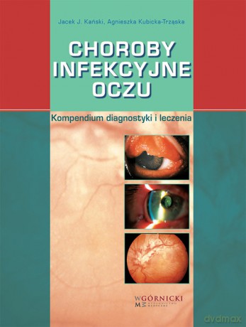 Choroby infekcyjne oczu - Jacek J. Kański, Agnieszka Kubicka-Trząska [KSIĄŻKA]
