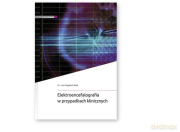 Elektroencefalografia w przypadkach klinicznych - Magdalena Bosak [KSIĄŻKA]