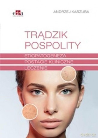 Trądzik pospolity - A. Kaszuba [KSIĄŻKA]