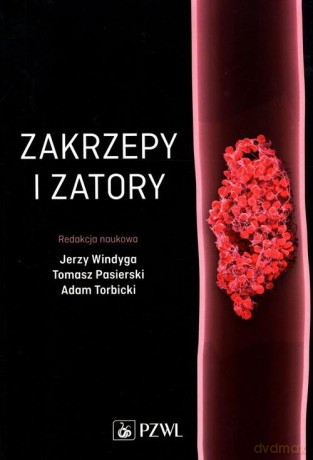 Zakrzepy i zatory - Tomasz Pasierski [KSIĄŻKA]