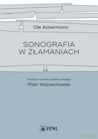 Sonografia w złamaniach - Ole Ackermann [KSIĄŻKA]