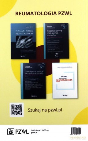 Obrazy kliniczne tocznia rumieniowatego układowego Część 2 - Maria Majdan [KSIĄŻKA]