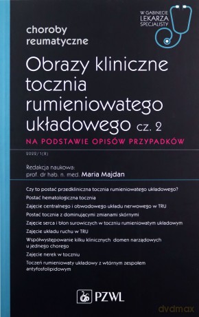 Obrazy kliniczne tocznia rumieniowatego układowego Część 2 Na podstawie opisów przypadków - Maria Majdan [KSIĄŻKA]