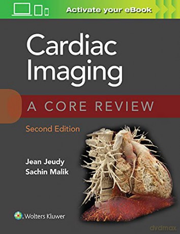 Cardiac Imaging: A Core Review - Jean Jeudy [KSIĄŻKA]