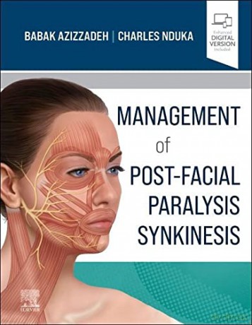 Management of Post-Facial Paralysis Synkinesis - Babak Azizzadeh MD FACS [KSIĄŻKA]