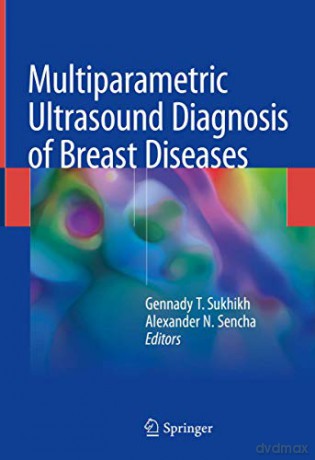 Multiparametric Ultrasound Diagnosis of Breast Diseases - Gennady T. Sukhikh [KSIĄŻKA]