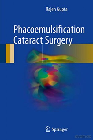 Phacoemulsification Cataract Surgery - Rajen Gupta [KSIĄŻKA]
