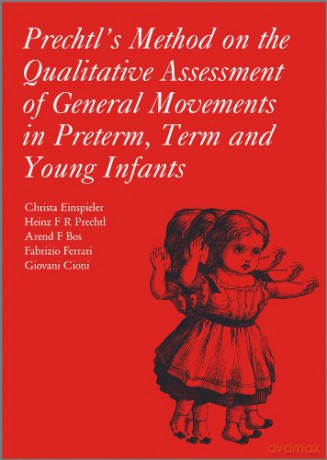 Prechtl's Method on the Qualitative Assessment of General Movements in Preterm, Term and Young Infants (Clinics in Developmental Medicine) - Christa Einspieler [KSIĄŻKA]
