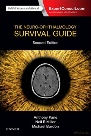 The Neuro-Ophthalmology Survival Guide, 2e [KSIĄŻKA]