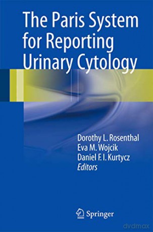 The Paris System for Reporting Urinary Cytology - Dorothy L. Rosenthal [KSIĄŻKA]