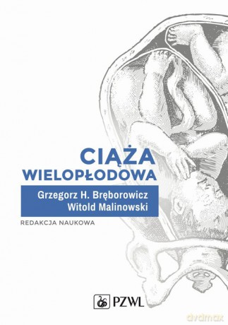 Ciąża wielopłodowa - H. Bręborowicz Grzegorz, Witold Malinowski [KSIĄŻKA]