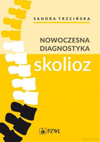 Nowoczesna diagnostyka skolioz - Sandra Trzcińska, Kamil Koszela [KSIĄŻKA]
